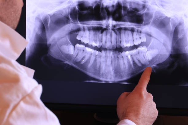 Best Emergency Treatment for Dental Infections or Abscesses in Poipu, HI