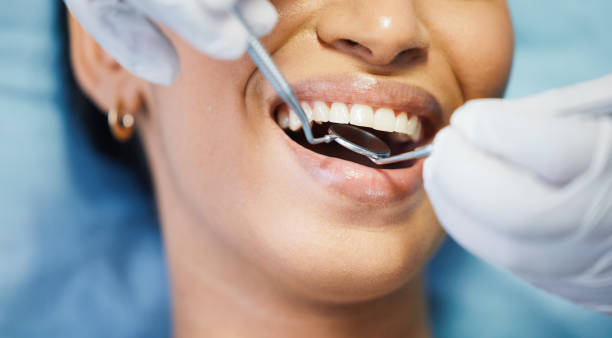 Best Emergency Gum Treatment in Poipu, HI